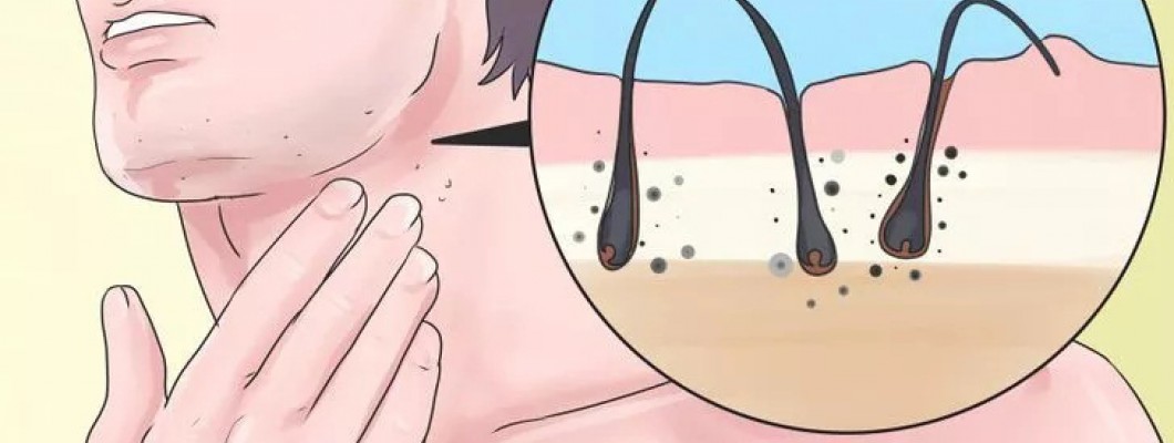 Cách chăm Sóc Khuôn Mặt Để Có 1 Bộ Râu Đẹp Cách chăm Sóc Khuôn Mặt Để Có 1 Bộ Râu Đẹp