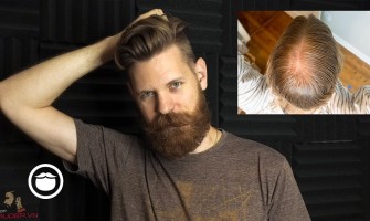 Các Phương Pháp Điều Trị Rụng Tóc Hiệu Quả Nhất Hiện Nay