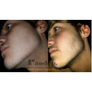 Dung Dịch Mọc Râu Kirkland Minoxidil 5% Dạng Lỏng - Nam