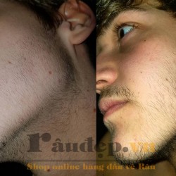 Dung Dịch Mọc Râu Kirkland Minoxidil 5% Dạng Lỏng - Nam