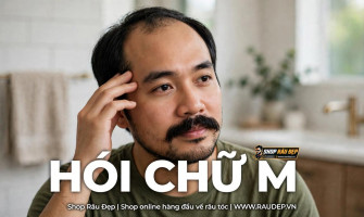 Hói Chữ M: Dấu Hiệu Nhận Biết Sớm, Nguyên Nhân Và Cách Xử Lý Kịp Thời