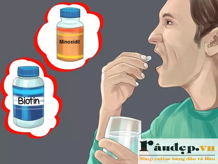 Minoxidil và Biotin trị hói đầu