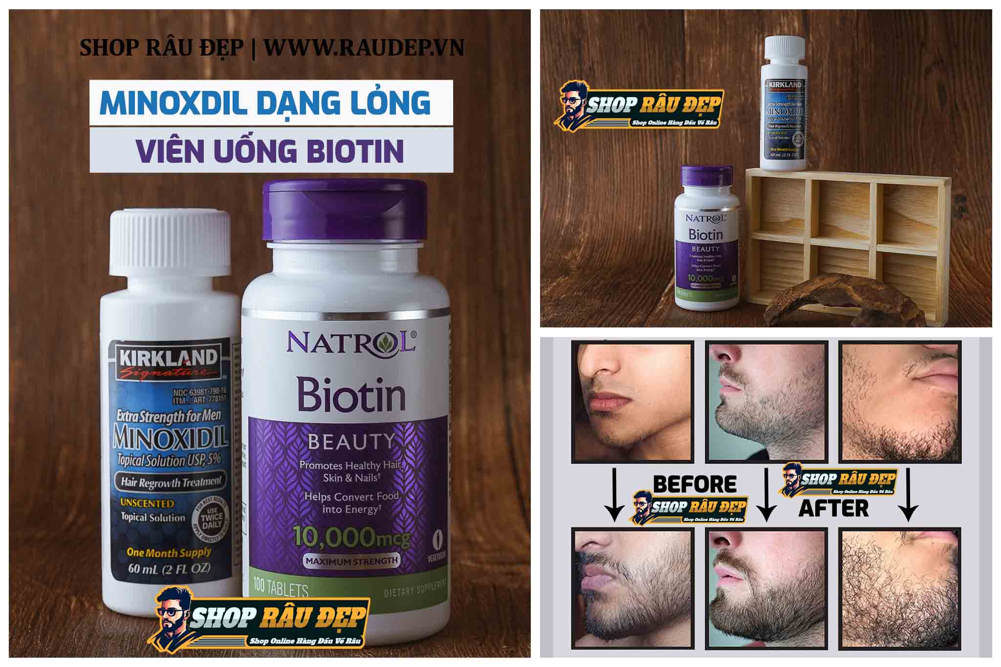 Phương pháp kích thích mọc râu dùng thuốc mọc râu Minoxidil 5% + thuốc hỗ trợ Biotin 10,000 mcg